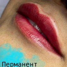 image-0-1